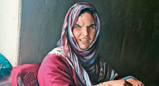 कश्मीरः सरकार ने छीनी आंखें, जज्बे ने सिर उठाया